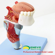 THROAT02(12506) Larynx Model with Toungue and Teeth, Full Size Enlarge, 5 Parts, E.N.T. Models > Larynx Models